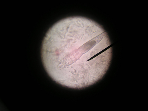 Demodex mite causes bald spots in a cat's back.
