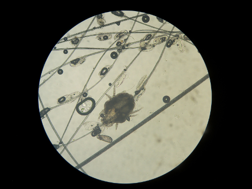 A mite seen under a microscope
